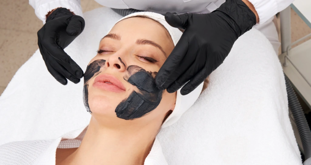 Everything You Need to Know About a Laser Carbon Peel