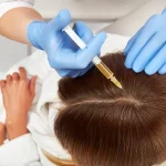 Is PRP Hair Treatment Permanent?
