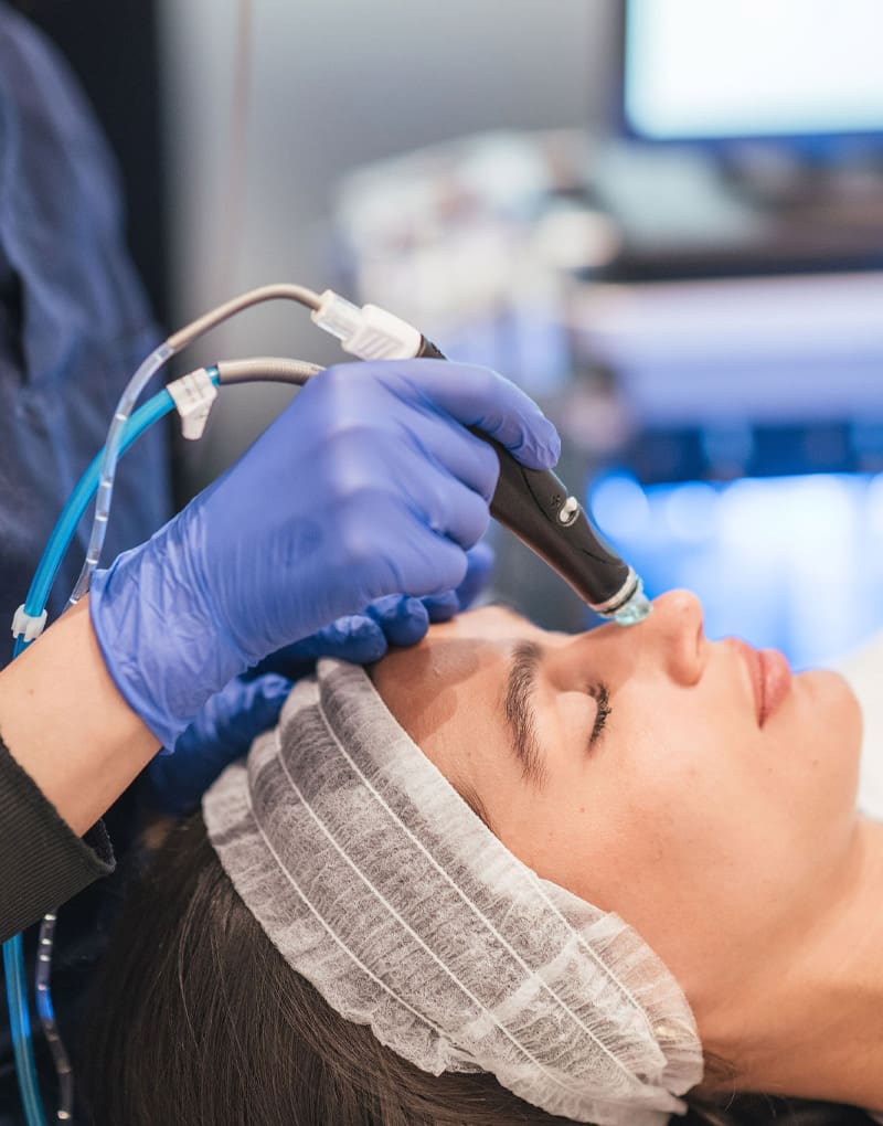 HydraFacial treatment in progress at Halcyon Medispa in Marylebone, London