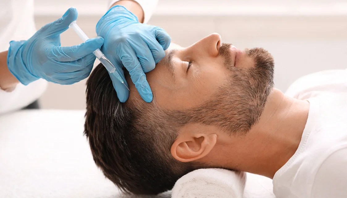PRP hair loss treatment with a doctor at Halcyon Medispa in Marylebone, London