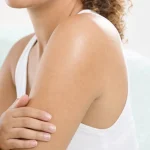 Keratosis Pilaris: What Actually Works on Chicken Skin