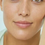 What Should I Avoid Before and After Lip Injections?